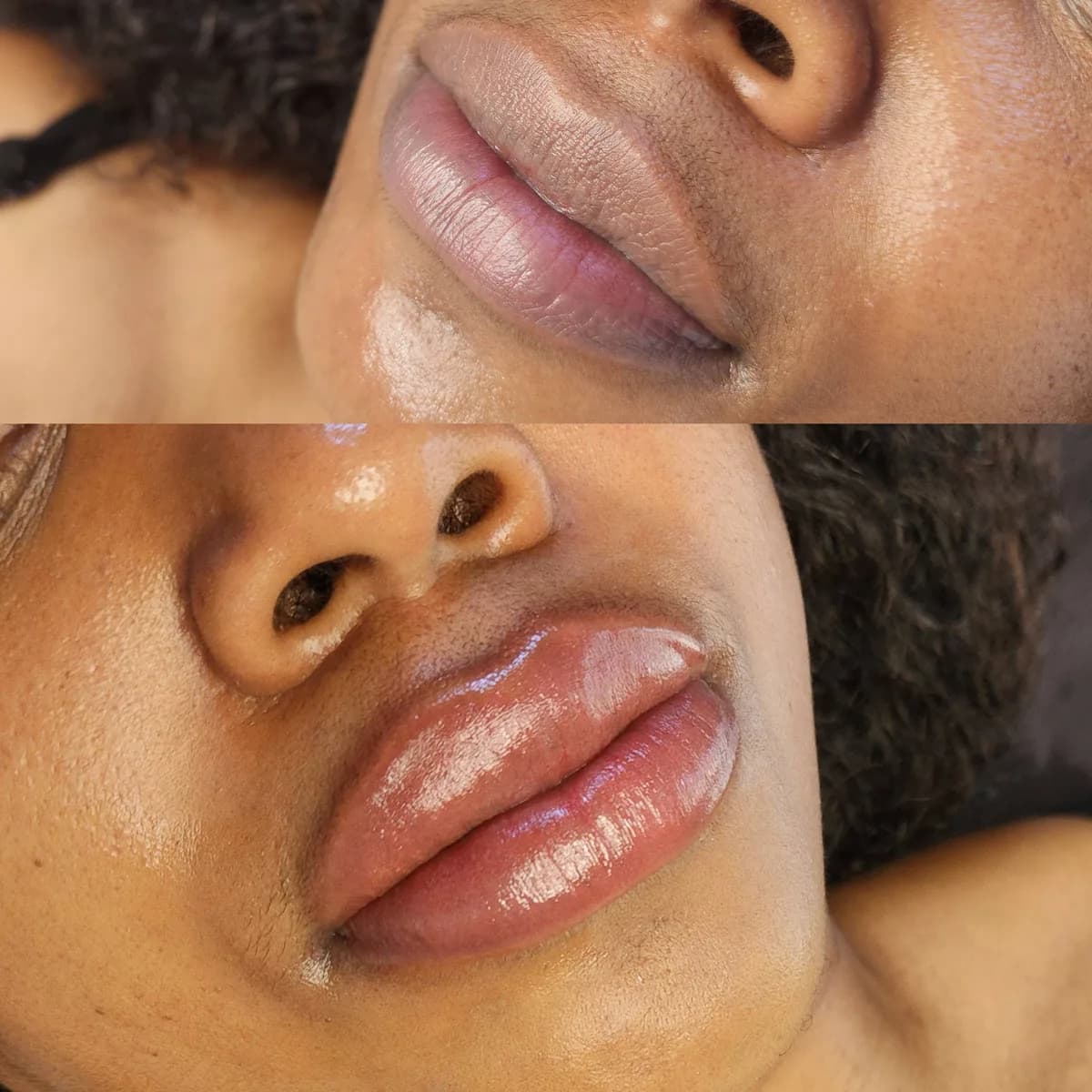 Before and after: Dark lip neutralisation