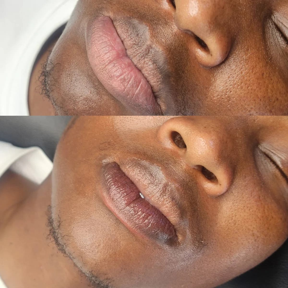 Before and after: Dark lip neutralisation
