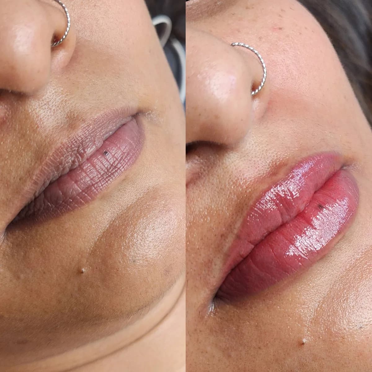 Before and after: Dark lip neutralisation
