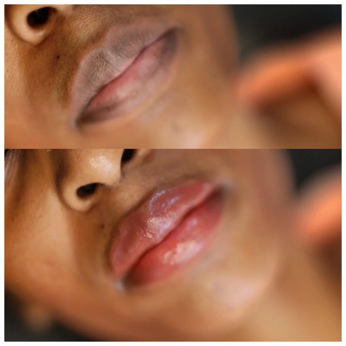 Before and after: Dark lip neutralisation
