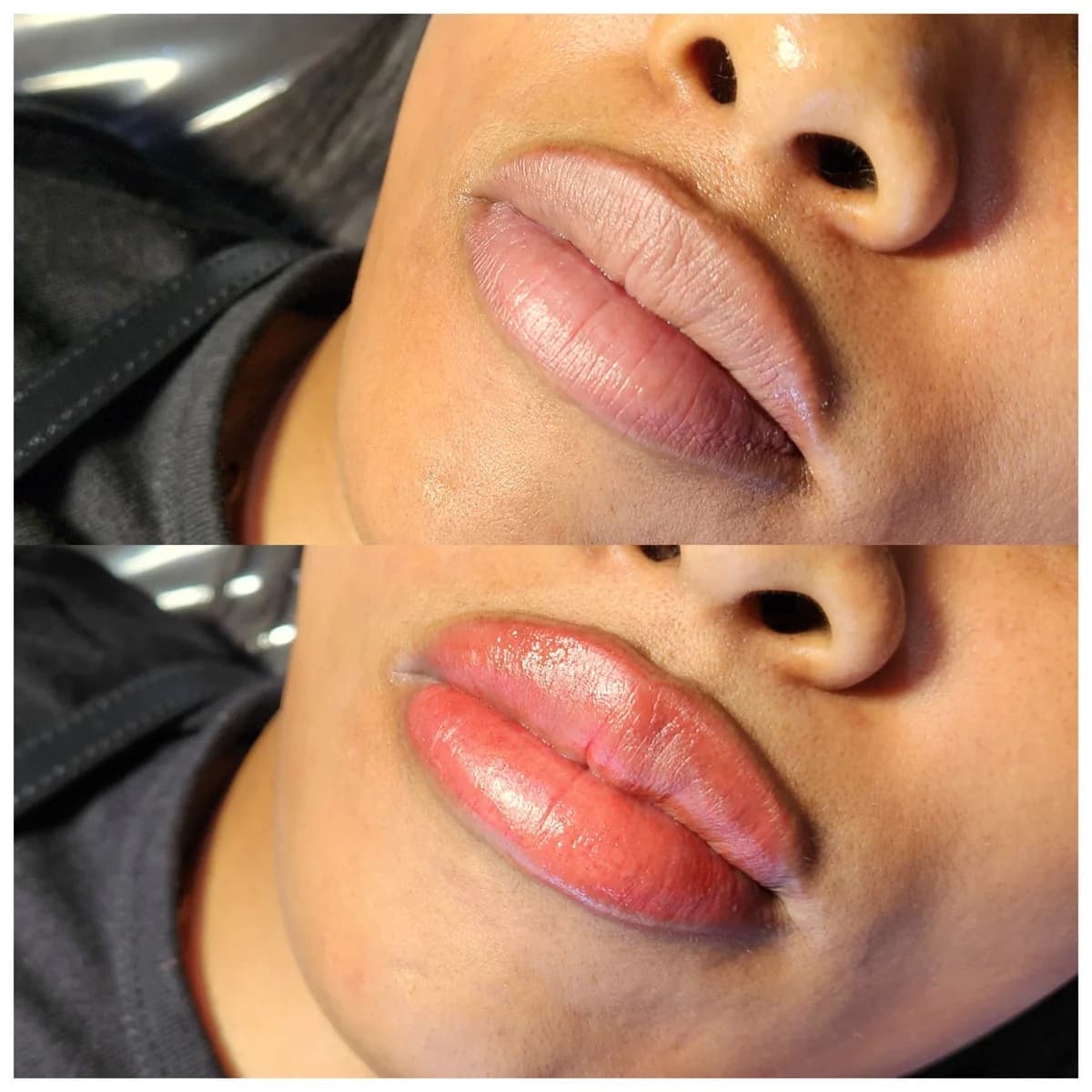 Before and after: Dark lip neutralisation