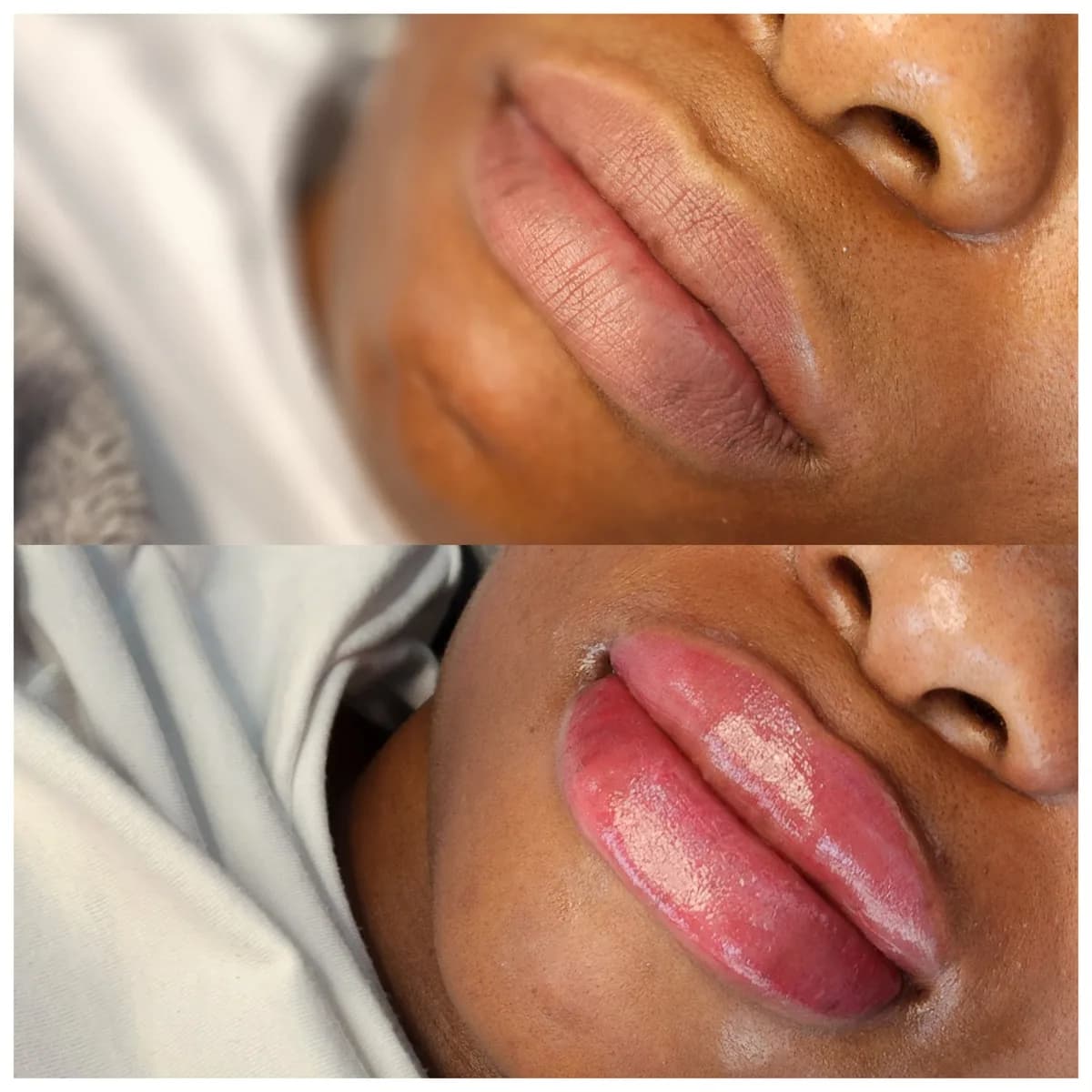 Before and after: Dark lip neutralisation