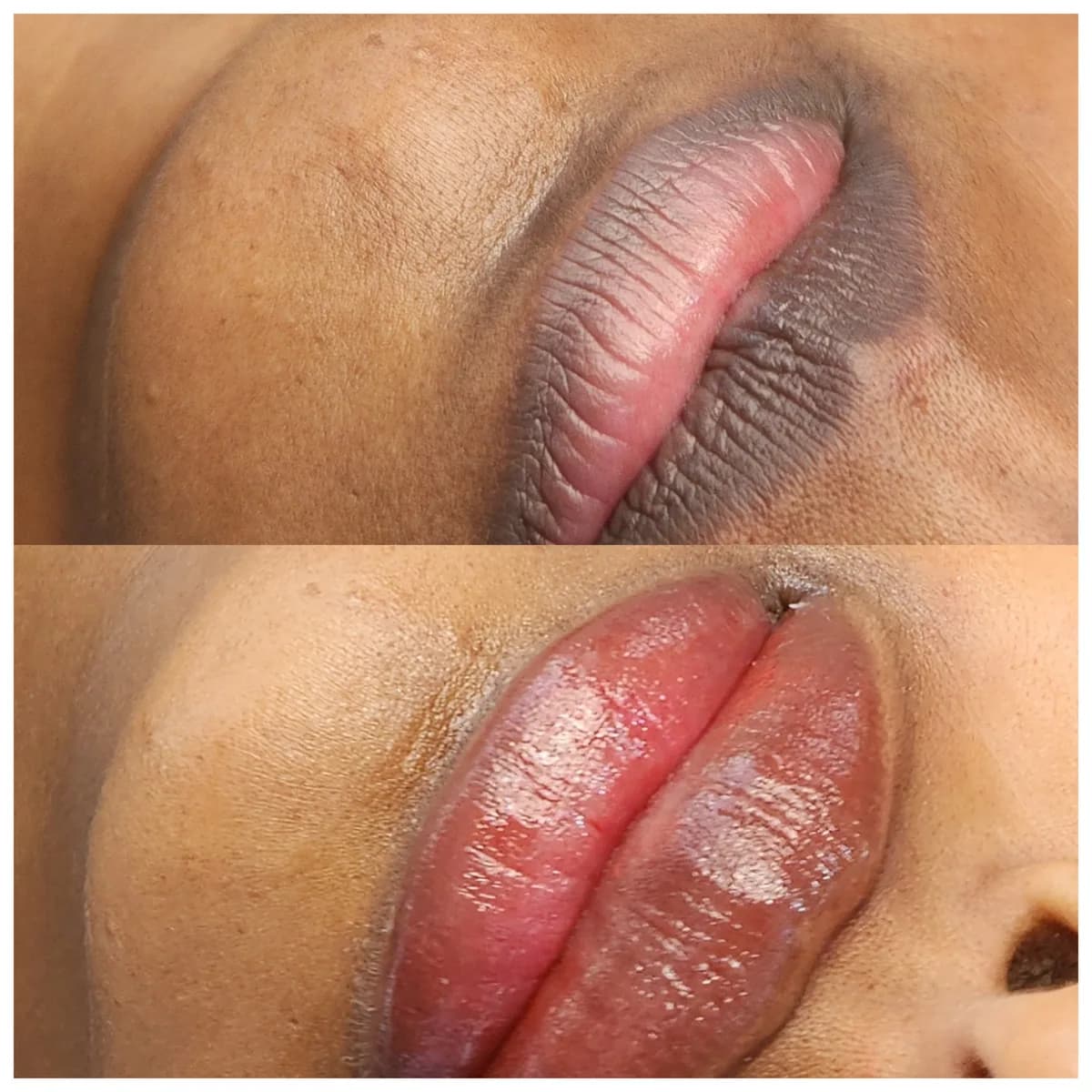 Before and after: Dark lip neutralisation