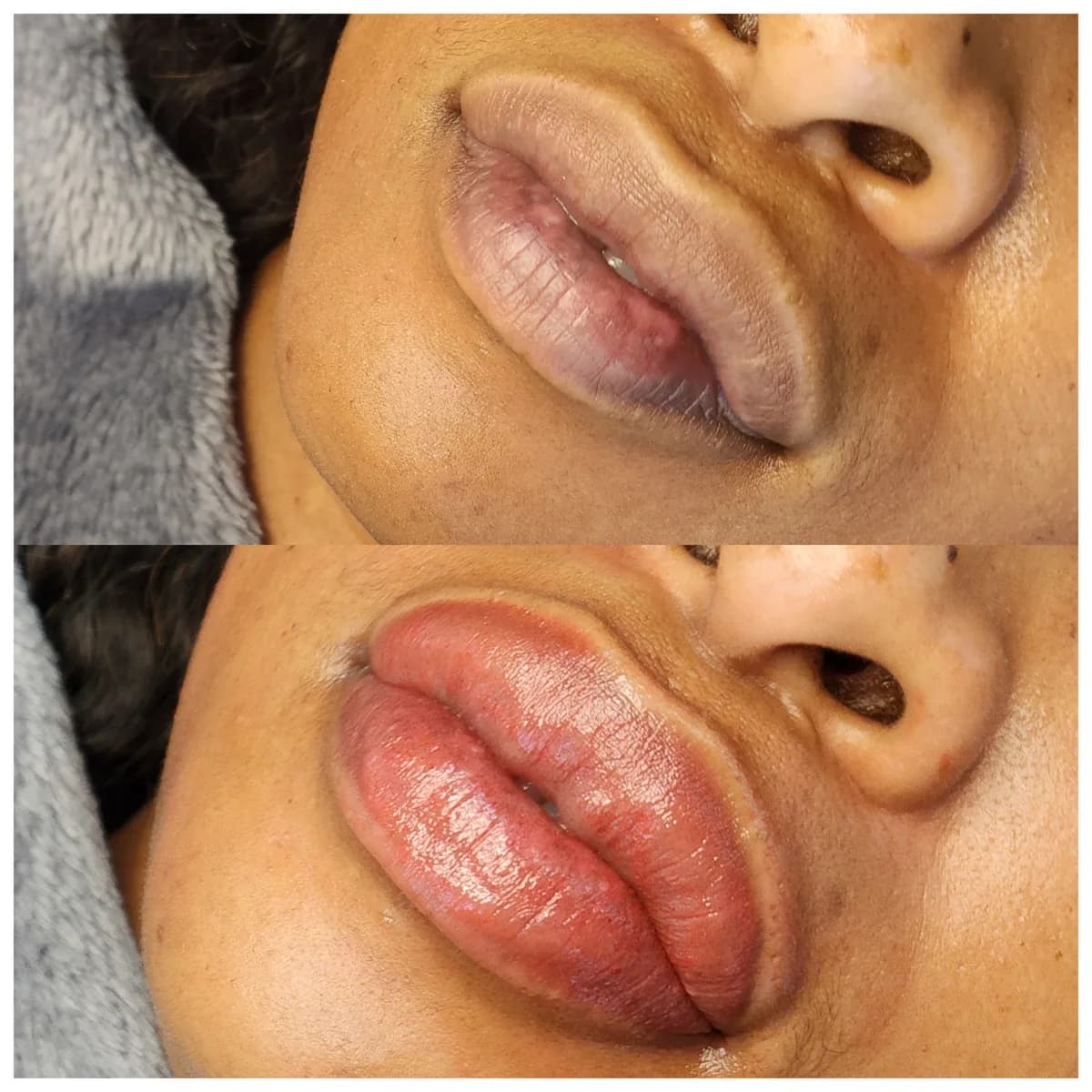 Before and after: Dark lip neutralisation