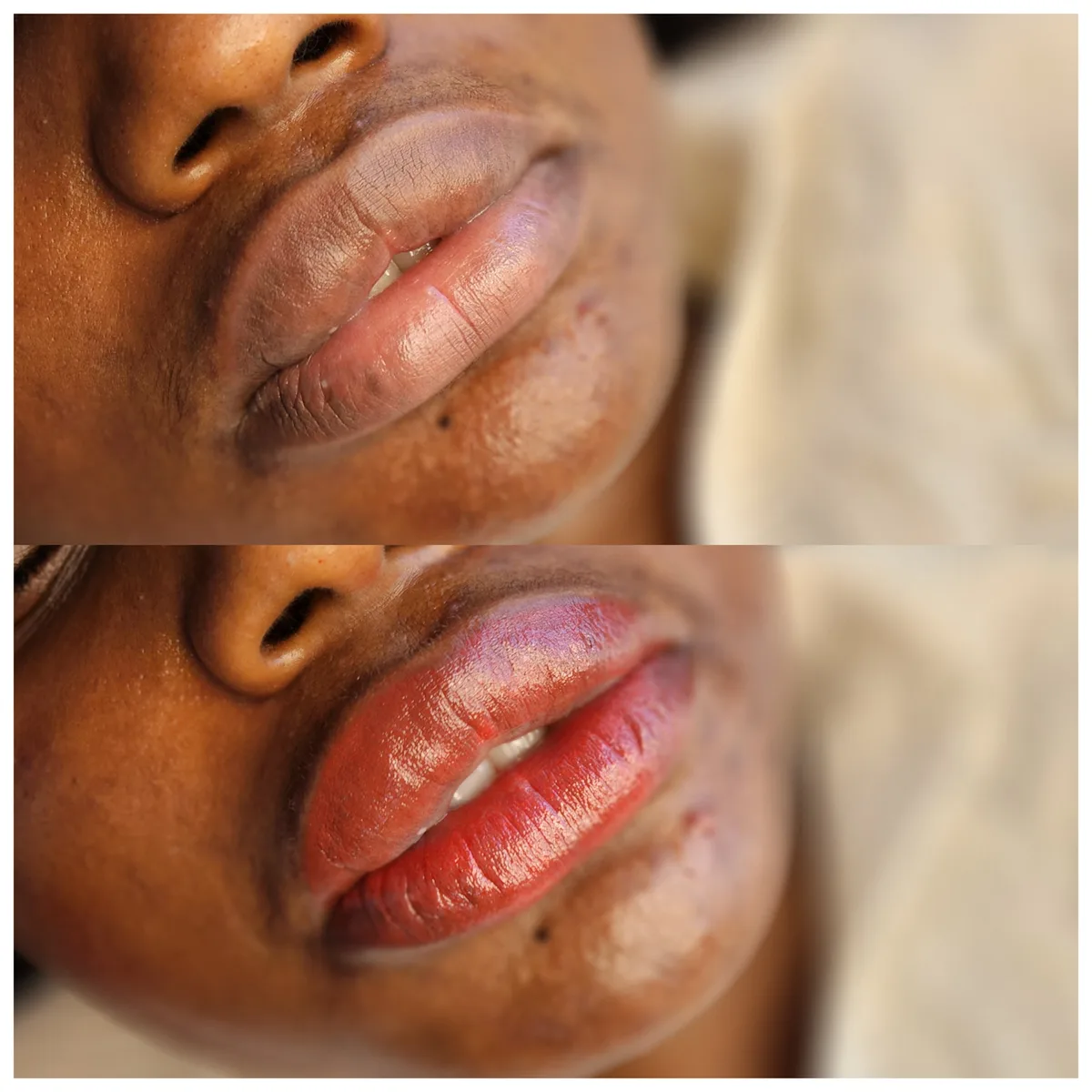 Before and after: Dark lip neutralisation