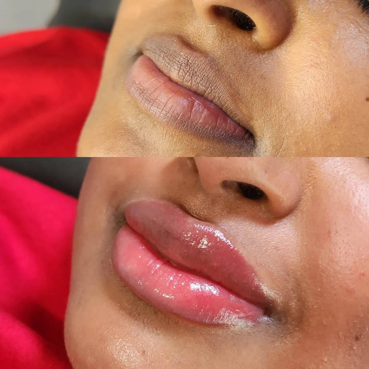 Before and after: Dark lip neutralisation