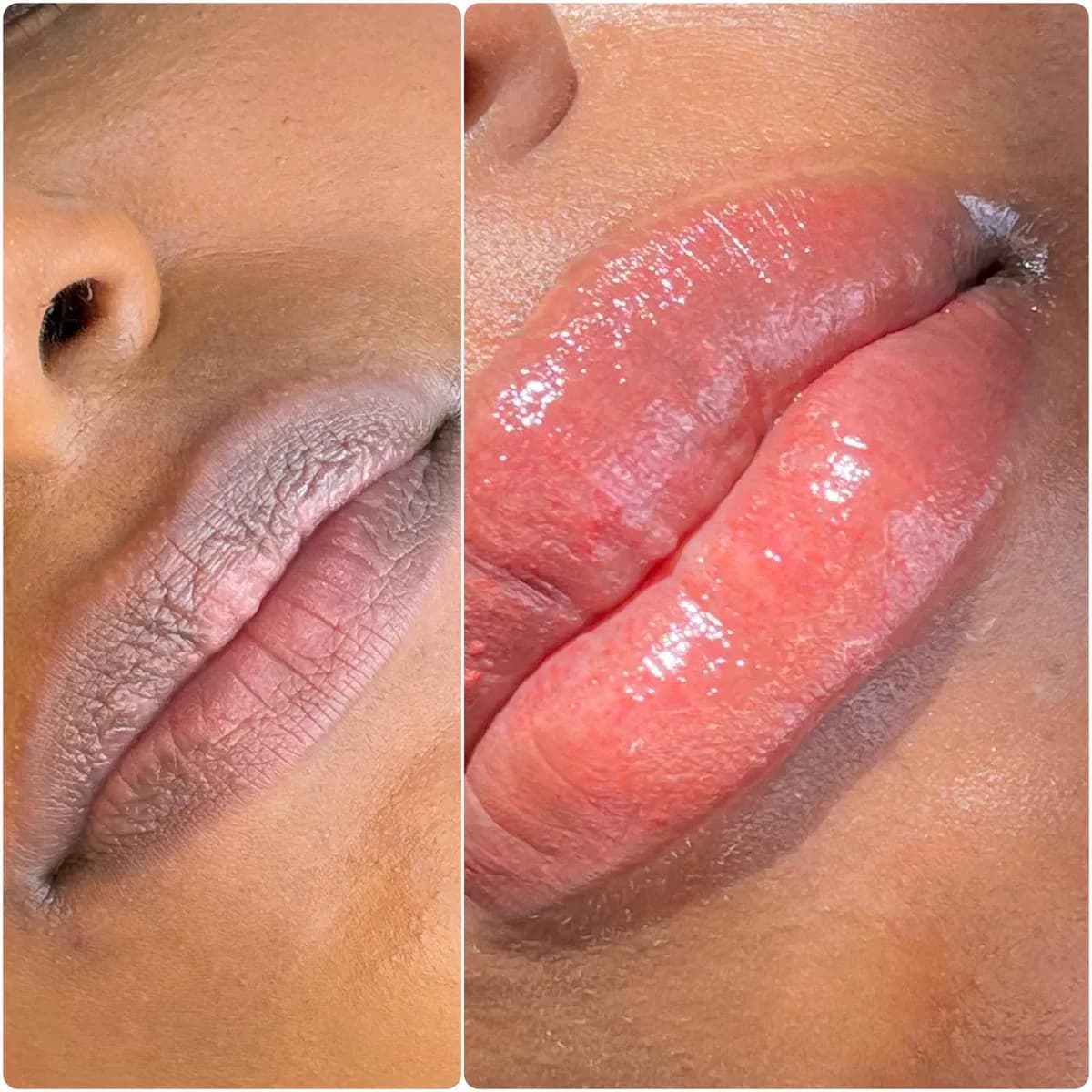 Before and after: Dark lip neutralisation
