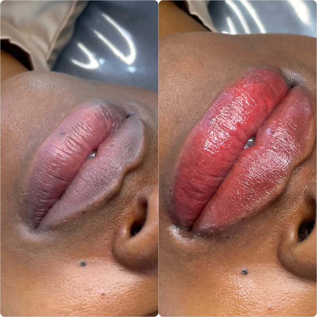 Before and after: Dark lip neutralisation