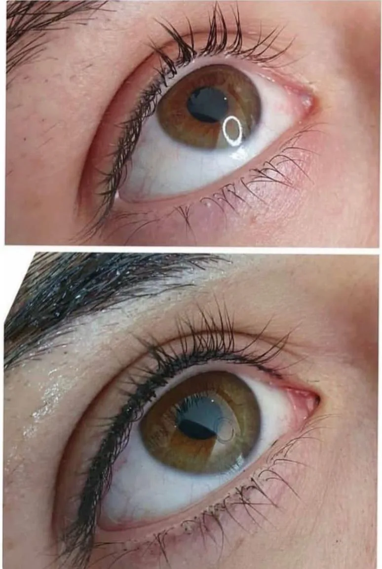 Before and after: Eyeliner tattoo