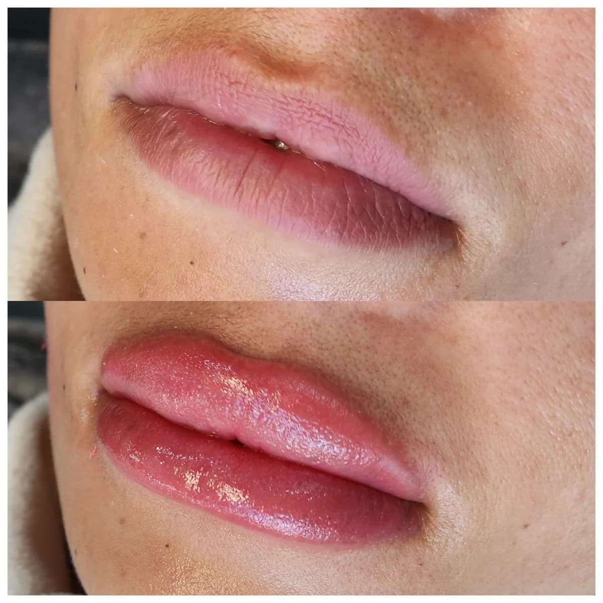 Before and after: Lip blush